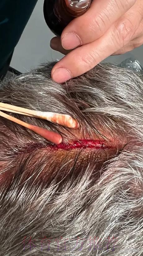 记者:安帅对纳乔红牌动作迷惑 两人均已向波图致歉 记者:安帅对纳乔红牌动作迷惑 两人均已向波图致歉